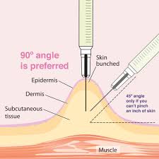 Image result for Subcutaneous Injection