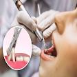 Dental Extractions Treatment (Simple & Surgical) product image