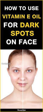 How To Use Vitamin E Oil For Dark Spots On Face Dark Spots On Face Spots On Face Oils For Skin