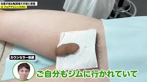 Japanese adult circumcision - ThisVid.com
