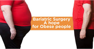 Bariatric Surgery A Hope For Obese People Bariatric Surgery Obese People Obesity