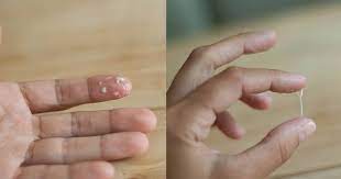 Maybe you would like to learn more about one of these? After Ovulation How Does Cervical Mucus Look Like