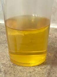 Buzz burrows, environment equipment pty ltd; Smelling Urine When None Is Around Scary Symptoms