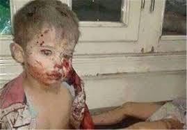 Image result for ‫جرائم العدوان على اليمن‬‎