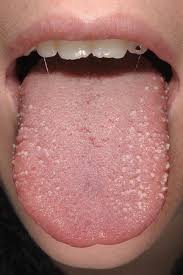 Diesen knoten verwendet man zu festmachen an einem ring oder zum anstecken von enden an runden objekten, wie einem ankerring. Erkrankungen Der Lippen Und Der Mundhohle Springerlink