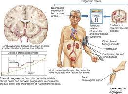 Maybe you would like to learn more about one of these? Brain Chat Vascular Dementia Is The Second Most Common Facebook