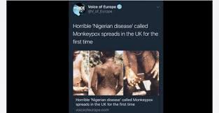 Monkeypox outbreak confirmed in uk as cases under investigation. Ncdc Ø¹Ù„Ù‰ ØªÙˆÙŠØªØ± We Are Live Chikwe I Is Speaking On How We Are Protecting Health Security At The Frontlines In Nigeria If You Can T Join Via Https T Co Zbtcyilb0g We Will Tweet With Chikweatlshtm