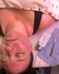 Theraderm!!!! I absolutely love this product after a good dermaplane  treatment for many reasons. This peptide-based antioxidant-rich gel  utilizes botanical enzymes extracted from papaya to gently exfoliate dead  skin cells. What Does