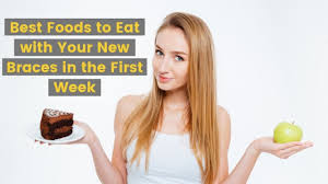 Maybe you would like to learn more about one of these? What Are The Best Foods To Eat With Your New Braces In The First Week Urbandale Smiles