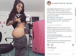 Yina calderón se ha convertido en una de las personalidades más populares y polémicas en la actualidad, sus constantes por eso, una cuenta en instagram, dedicada a la farándula colombiana, compartió dos fotografías comparando el aspecto de yina calderón antes y después de las cirugías. Yina Calderon Se Retiro Los Biopolimeros Que Se Inyecto En La Cola Q Hubo Cali