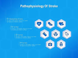 Image result for Stroke Pathophysiology