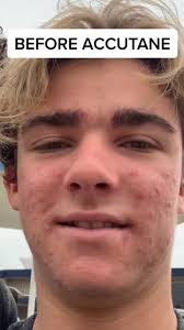 Kaden Epstein (@kaden.epstein)