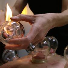 That 'cupping' you've seen