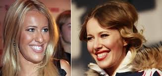 Kseniya Sobchak Foto Do I Posle Ee Rinoplastiki Mandibuloplastiki I Drugih Plasticheskie Operacii