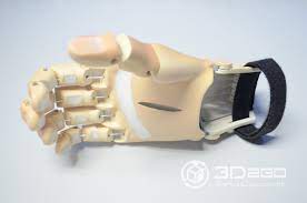 A Closer Look The 3d Printed Prosthetic Hand For Grasping Objects Specifically Designed And Customized For Melan 3d Printing 3d Printing Service Prosthetics