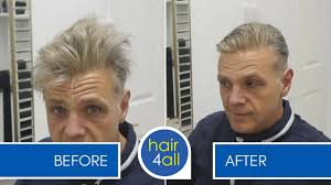 How to Fix Bed Hair (Hair Replacement System) for Men with Phil Osmond!  Justin Bieber Style!