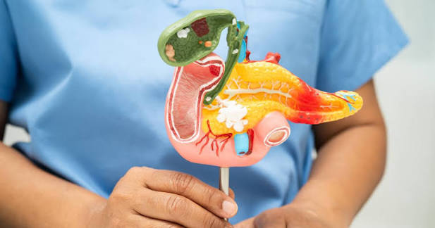 Câncer de pâncreas: mais comum que antes, entenda por que ele é desafiador  | Instituto Oncoguia