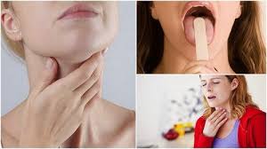 Cancerul De Gat Greu De Tratat In Romania Cancerul De Gat