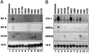 Sila gunakan pelayar (browser) google chrome atau internet awam malaysia (spa) dengan kerjasama mampu telah membangunkan aplikasi mudah alih myspa8i sebagai alternatif kepada sistem spa8i versi web. Combinatorial Action Of Hnf3 And Sp Family Transcription Factors In The Activation Of The Rabbit Uteroglobin Cc10 Promoter Journal Of Biological Chemistry
