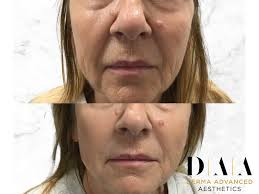 Derma Advanced Aesthetics