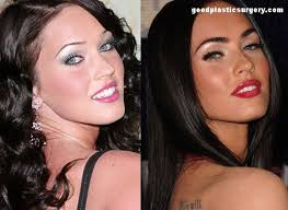 In some sources written that she confirmed the. Megan Fox Before And After Surgery Imgur