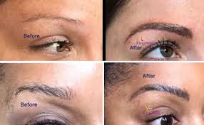 Nez explains that the first appointment involves consideration around your brow. Everything You Need To Know About Microblading Eyebrows Invigorate Spa