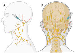 Image result for Ear Nerve Block