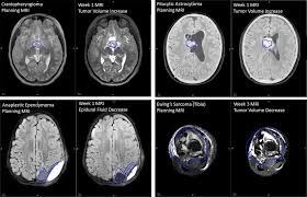 You may need to install the light bulb before you install the trim, depending on the trim you have selected. Clinical Implementation Of Magnetic Resonance Imaging Systems For Simulation And Planning Of Pediatric Radiation Therapy Journal Of Medical Imaging And Radiation Sciences
