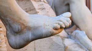 Diabetic neuropathy is a serious diabetes complication that may affect as many as 50% of people with diabetes. Best Diet For Diabetic Neuropathy Nutritionfacts Org