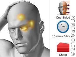 Image result for Cluster Headache