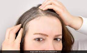 The average age that hair starts going gray is the mid 30s for caucasians, late 30ss for asians and mid 40s for afro. 5 Causes Of Premature Greying Of Hair