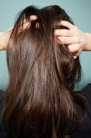 You may feel that the itch will never stop, but relief is possible. 4 Common Itchy Scalp Causes How To Treat It