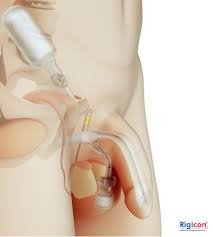 CİNSEL SAĞLIK – Üroloji Profesörü Üroloji Uzmanı Prof. Dr. Saadettin  Eskiçorapcı