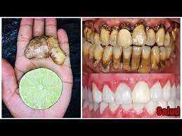 Limpia Tus Dientes Amarillos Y Elimina El Sarro En Tan Solo Dos Minutos Youtube Food The Creator Fruit