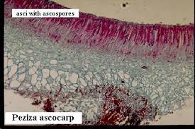 Division Ascomycota Peziza Cross Section Showing Asci In Cup Of The Cup Fungus Fungi Kingdom Fungi Protists