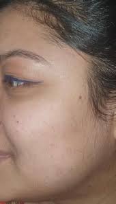 Skin Specialist Prof.Dr.Hasibur Rahman