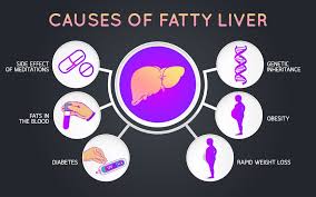 6 Tips To Reduce Fatty Liver Disease Common Complication Of