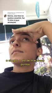 Retirando os Pontos do Siso: Experiência Pessoal