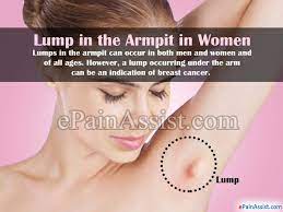 You must have your doctor evaluate any uncommon lumps you have. Lump In The Armpit Causes Symptoms Treatment Prognosis Diagnosis
