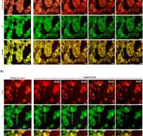 Thymoquinone chemically conjugated to doxorubicin: antitumor ...