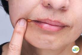 Pin On Health