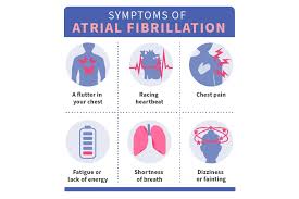 Image result for Atrial Fibrillation