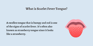 Image result for Scarlet Fever