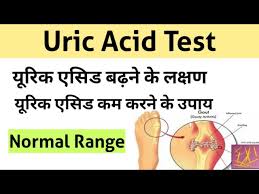 The current reference or normal range set for hyperuricemia often fails to identify patients with potential metabolic disorders 7. Uric Acid Test In Hindi Uric Acid Treatment Uric Acid Symptoms Youtube
