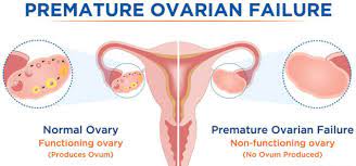 The causes for premature menopause could be diseases or certain treatments or surgery to treat certain diseases. Unravelling The Mystery Behind Premature Ovarian Failure Bridge Clinic