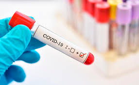 In contrast to influenza, the risk of disease and transmission in children is rather low in the case of covid. Corona Test Genspeed Schneller Als Das Labor Erlaubt Trend At
