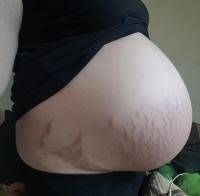 Woche und mein bauch fängt sich langsam an zu senken. Wieso Senkt Der Bauch Nicht Forum Schwangerschaft Urbia De