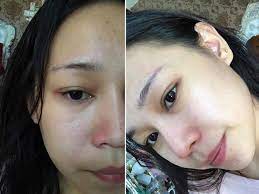 Jerawat merupakan musuh utama kepada semua orang termasuk lelaki dan wanita. Kulit Gadis Ini Putih Licin Tanpa Blackhead Caranya Cuma Guna Baking Soda Vanilla Kismis