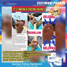 Satu satunya cara untuk mengetahui apakah anda memiliki hipertensi adalah dengan mengukur tekanan darah. Testimoni Ag Cera Darah Tinggi Ag Nutrition