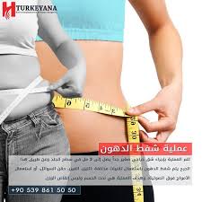 عملية شفط الدهون في مركز تركــيانــا تتم العملية بإجراء شق جراحي صغير جدا يصل إلى 3 مل في سطح الجلد وعن طريق هذا الجرح يتم شفط الدهون باستعمال تقنيات مختلفة Goruntuler Ile
